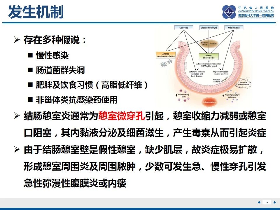 影像PPT - 【PPT】结肠憩室炎-15
