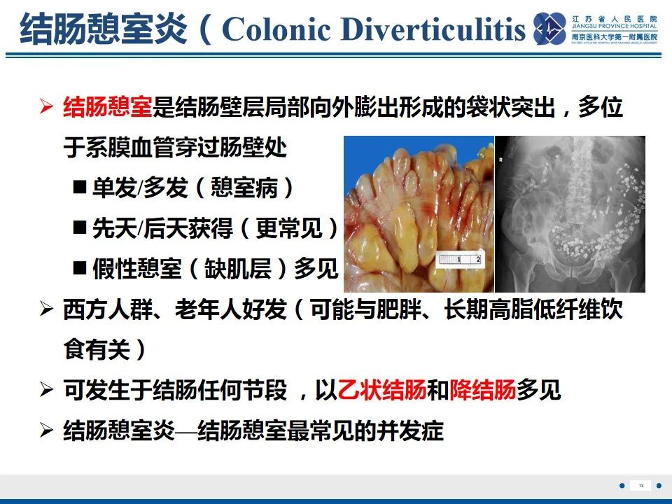影像PPT - 【PPT】结肠憩室炎-14