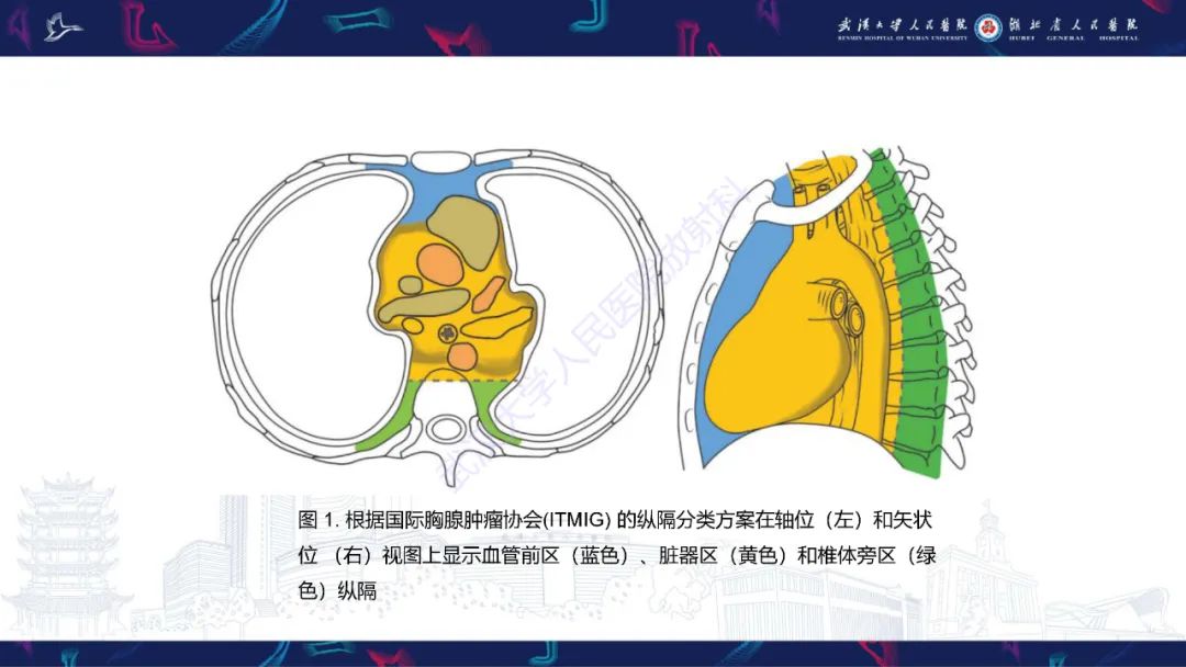 影像PPT - 【PPT】儿童纵隔占位影像诊断-3