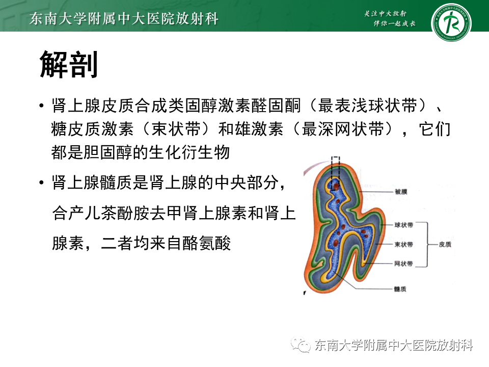 影像PPT - 【PPT】肾上腺皮质癌-7 影像PPT - 【PPT】肾上腺皮质癌-7