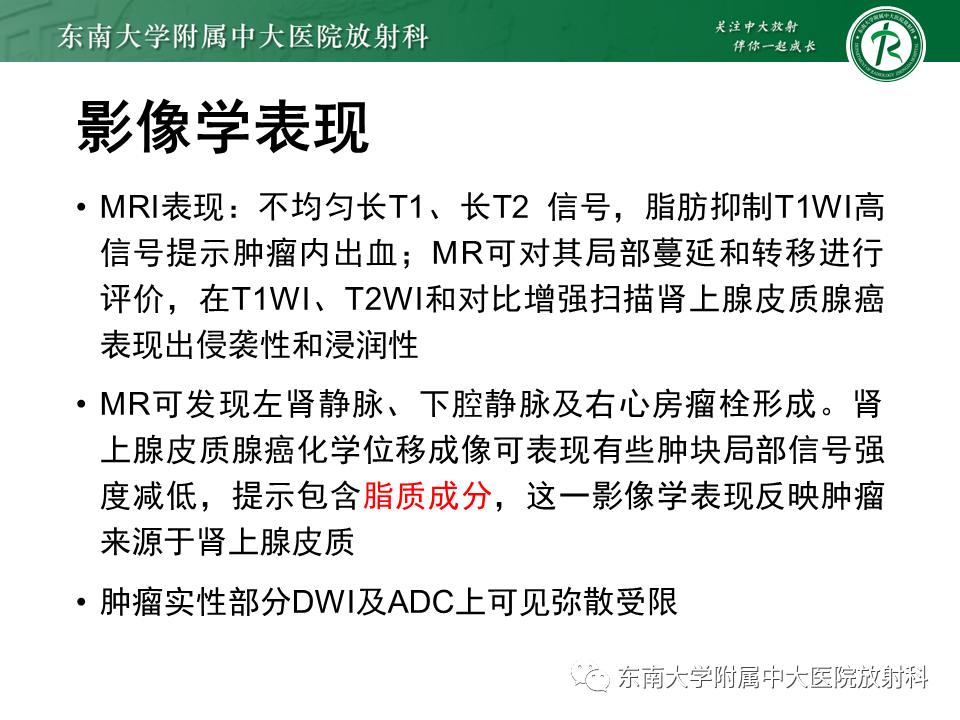影像PPT - 【PPT】肾上腺皮质癌-13 影像PPT - 【PPT】肾上腺皮质癌-13