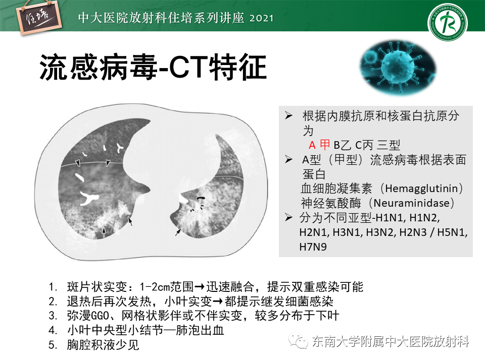 影像PPT - 【PPT】非典型肺炎及其重症病例的影像表现-27