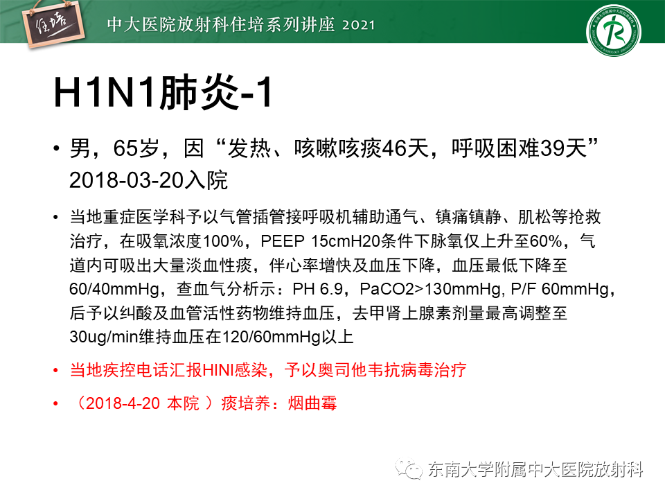 影像PPT - 【PPT】非典型肺炎及其重症病例的影像表现-28