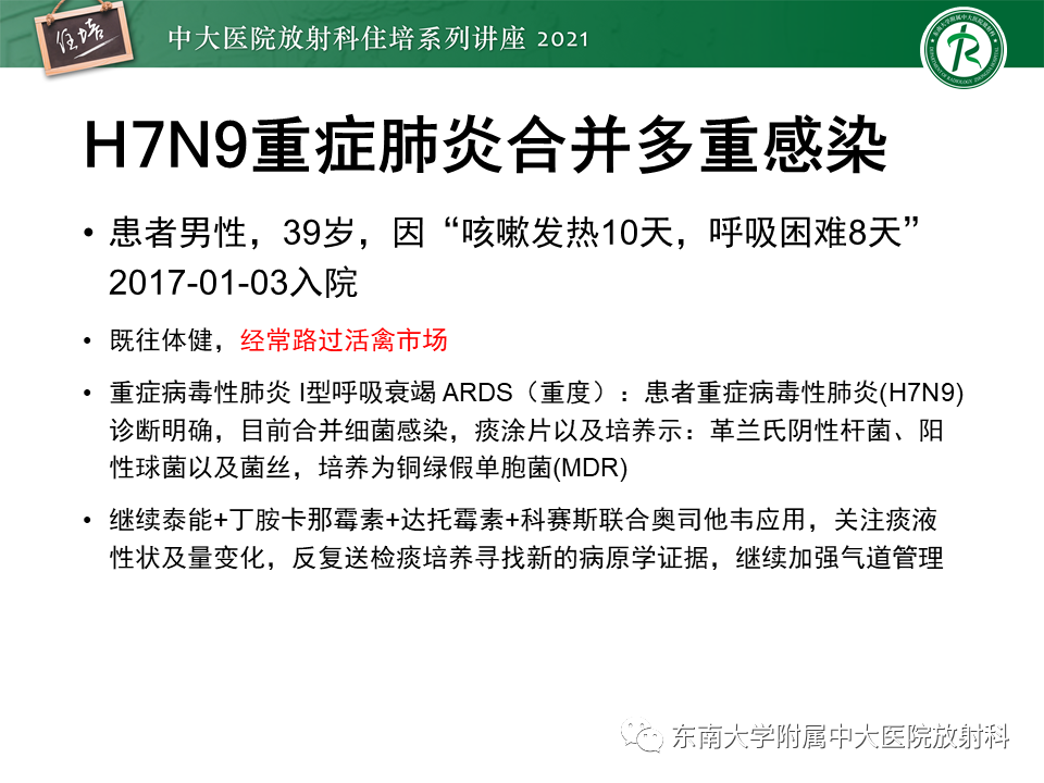 影像PPT - 【PPT】非典型肺炎及其重症病例的影像表现-32