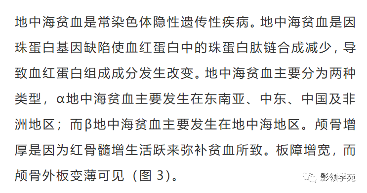 影像PPT - 颅骨增厚影像表现-5 影像PPT - 颅骨增厚影像表现-5