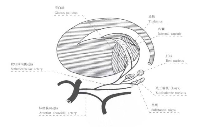影像PPT - 认识脉络膜前动脉—从解剖到临床-6 影像PPT - 认识脉络膜前动脉—从解剖到临床-6