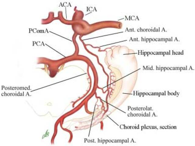 影像PPT - 认识脉络膜前动脉—从解剖到临床-10 影像PPT - 认识脉络膜前动脉—从解剖到临床-10