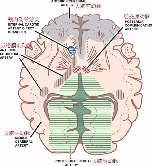 影像PPT - 认识脉络膜前动脉—从解剖到临床-17 影像PPT - 认识脉络膜前动脉—从解剖到临床-17