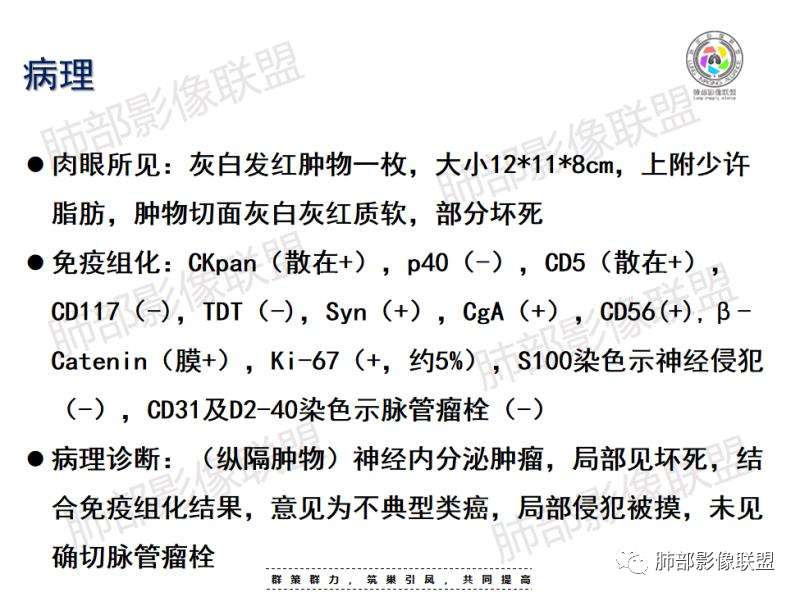 影像PPT - 【病例】前纵隔肿块—神经内分泌肿瘤1例-17 影像PPT - 【病例】前纵隔肿块—神经内分泌肿瘤1例-17