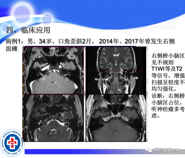 影像PPT - 【PPT】SPACE序列介绍-13