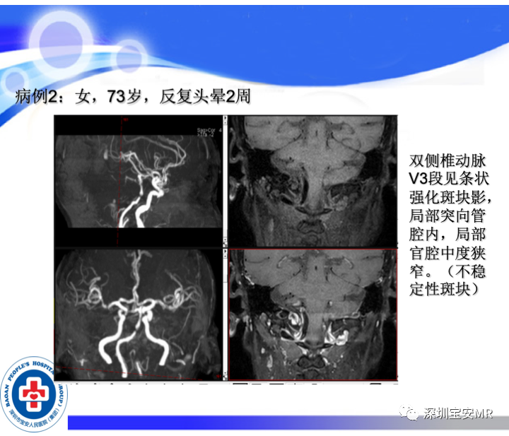 影像PPT - 【PPT】SPACE序列介绍-14