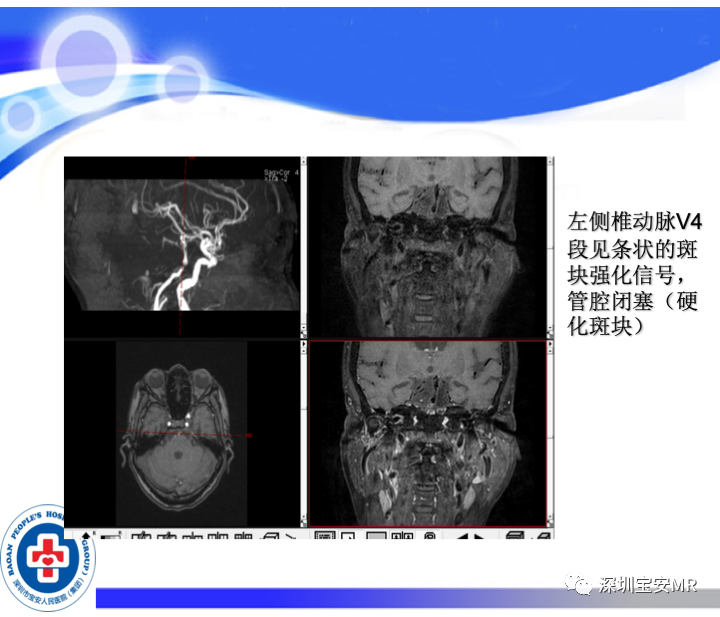 影像PPT - 【PPT】SPACE序列介绍-15