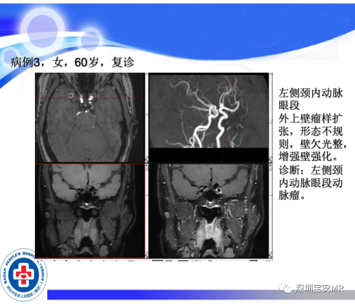 影像PPT - 【PPT】SPACE序列介绍-16