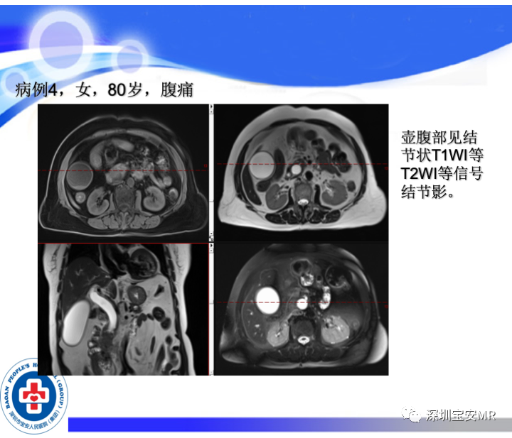 影像PPT - 【PPT】SPACE序列介绍-18