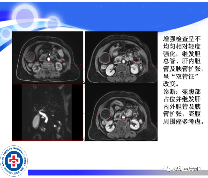 影像PPT - 【PPT】SPACE序列介绍-19