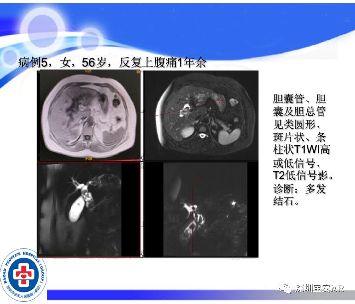 影像PPT - 【PPT】SPACE序列介绍-20