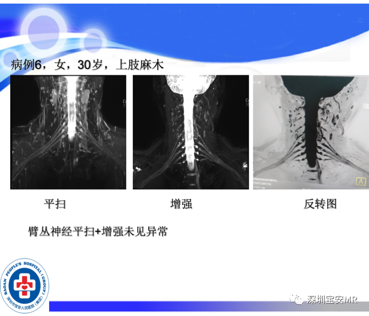 影像PPT - 【PPT】SPACE序列介绍-21
