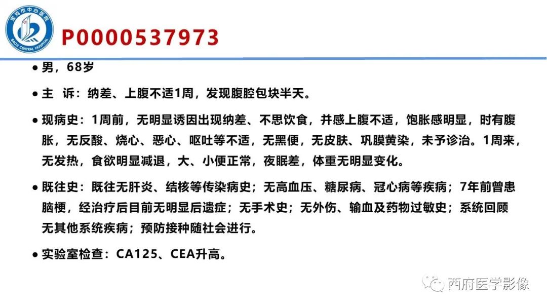 影像PPT - 【病例】胃神经鞘瘤1例CT影像-2