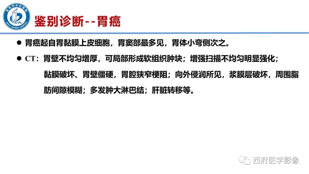 影像PPT - 【病例】胃神经鞘瘤1例CT影像-23