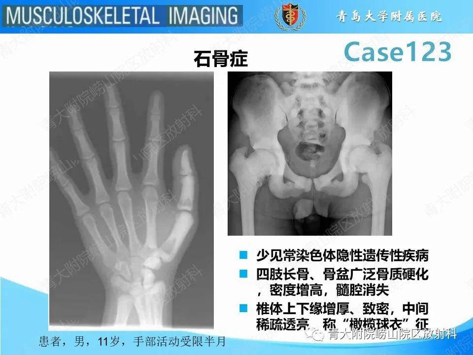 影像PPT - 【PPT】骨斑点症-8