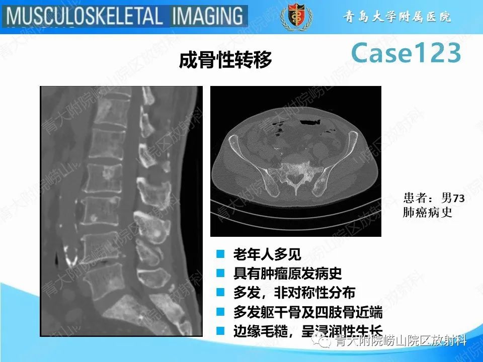 影像PPT - 【PPT】骨斑点症-7