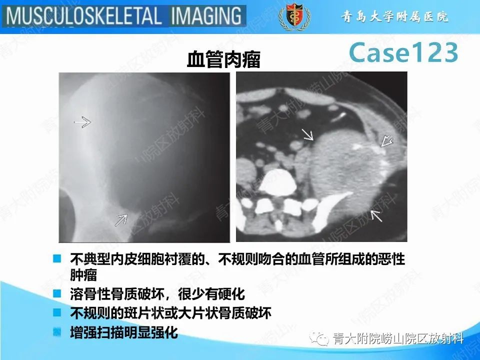 影像PPT - 【PPT】骨斑点症-10