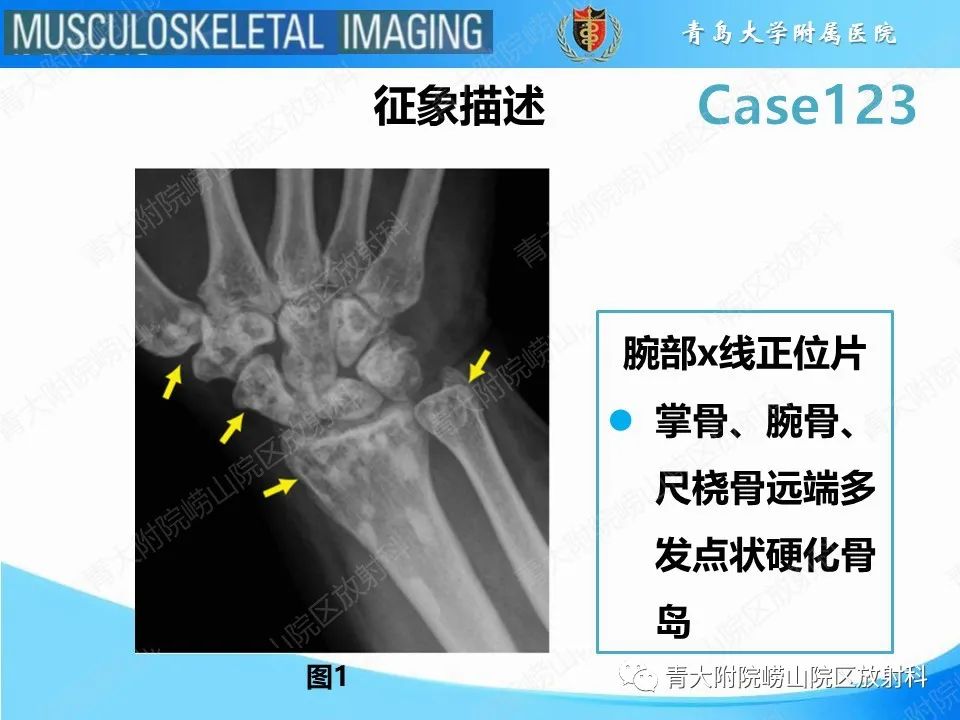 影像PPT - 【PPT】骨斑点症-18