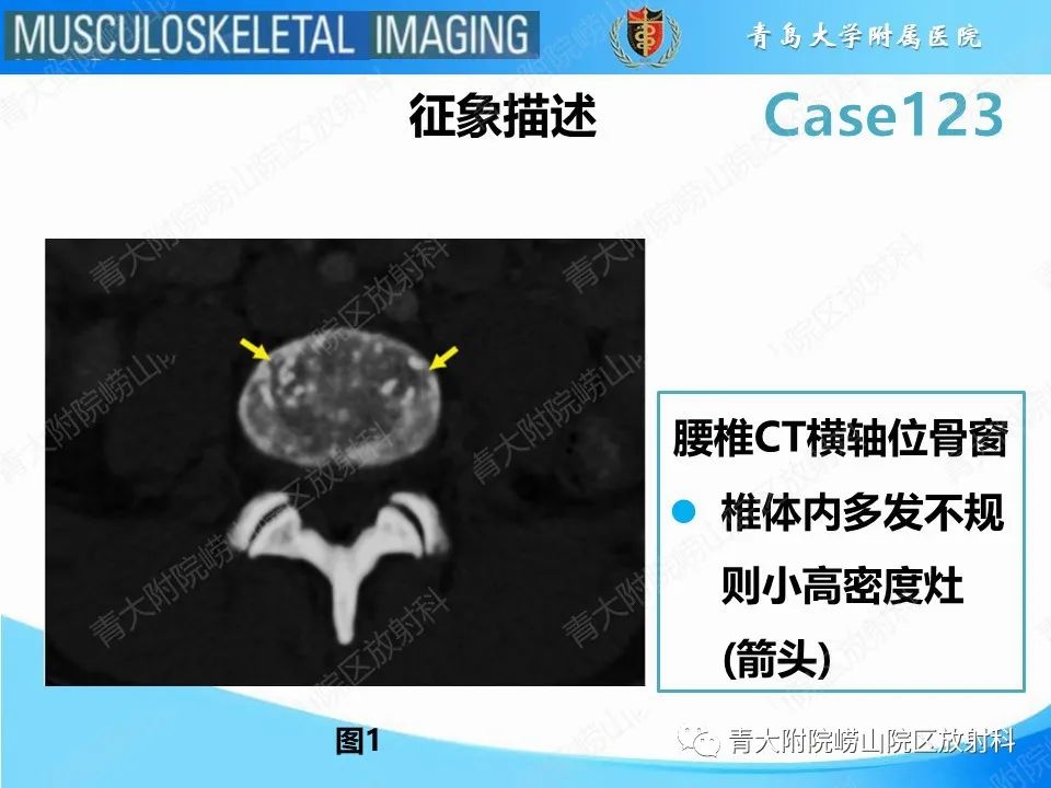 影像PPT - 【PPT】骨斑点症-17