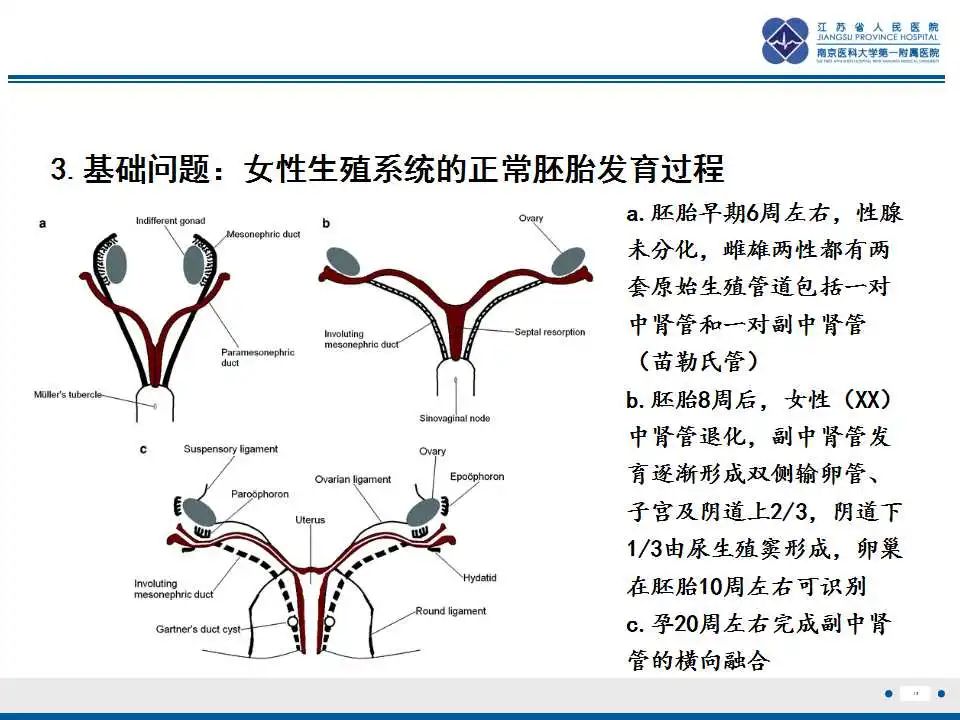 影像PPT - 【PPT】MRKH综合征-13