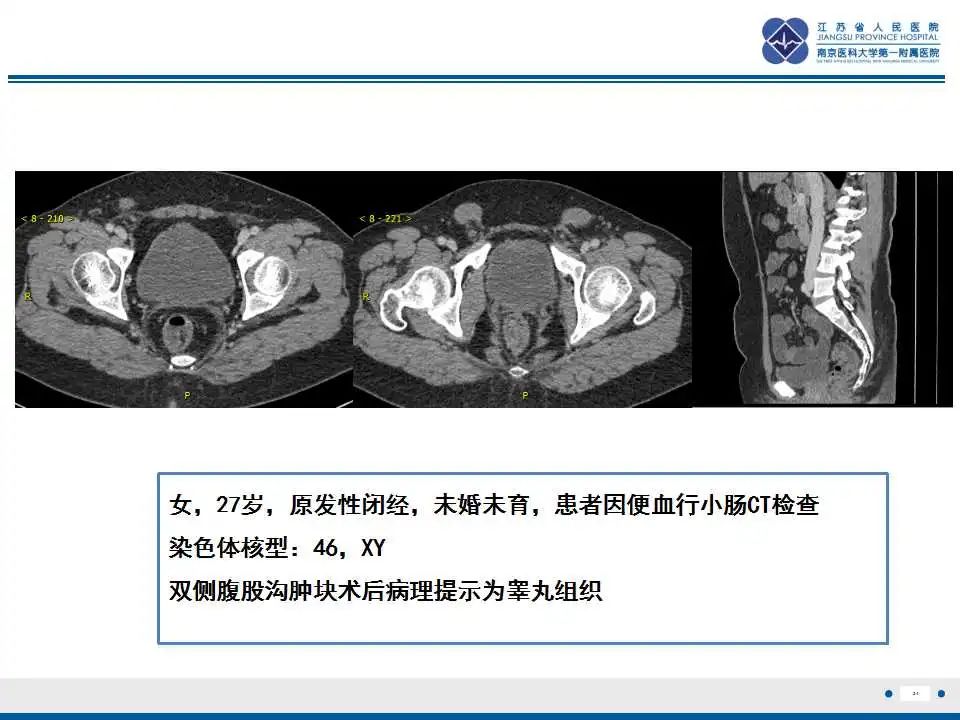影像PPT - 【PPT】MRKH综合征-24