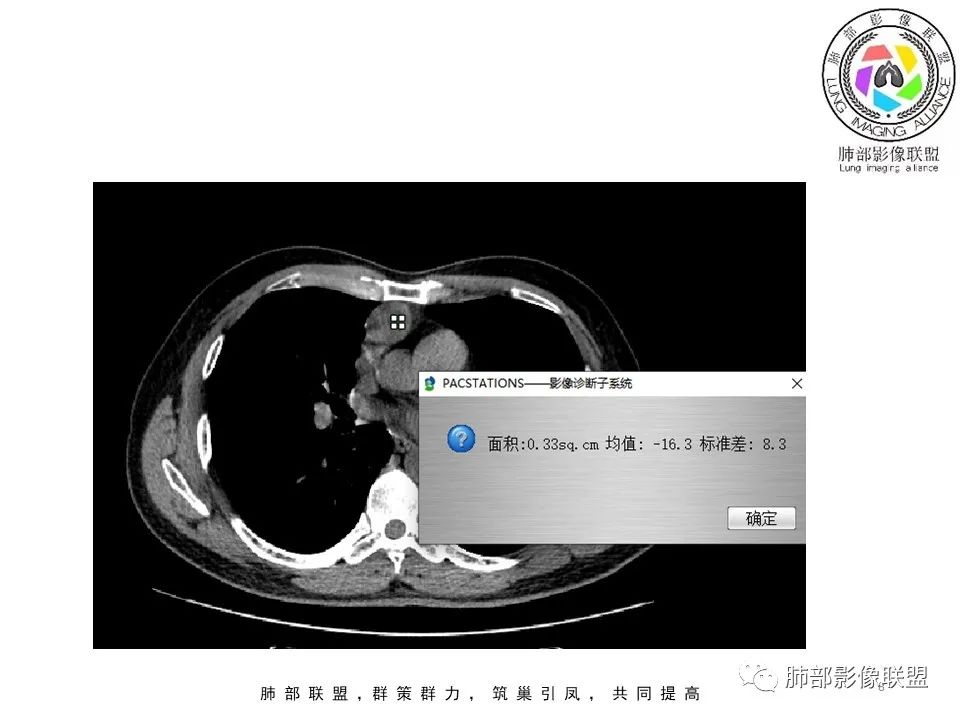 影像PPT - 【病例】前纵隔区最常见的肿瘤—胸腺瘤1例CT-8 影像PPT - 【病例】前纵隔区最常见的肿瘤—胸腺瘤1例CT-8