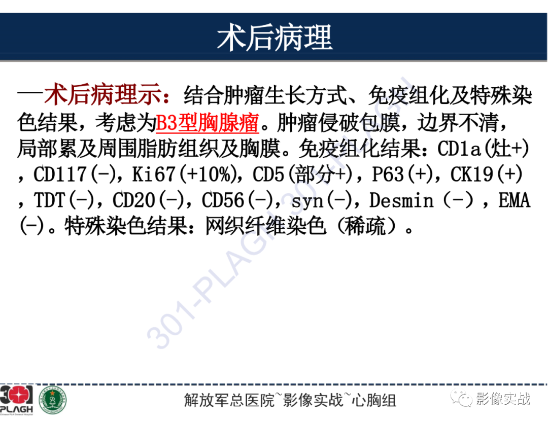 影像PPT - 【病例】前纵隔侵袭性胸腺瘤1例CT影像-15