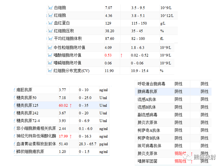 影像PPT - 【病例】肺隔离症2例CT影像-3