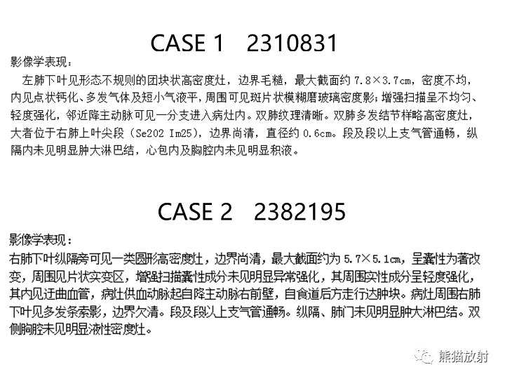 影像PPT - 【病例】肺隔离症2例CT影像-19