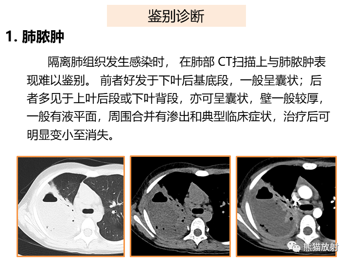 影像PPT - 【病例】肺隔离症2例CT影像-28
