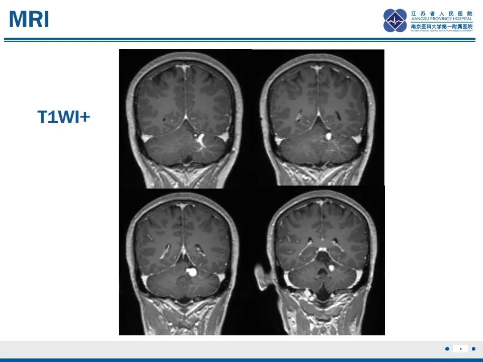 影像PPT - 【PPT】海绵状血管瘤伴发育性静脉畸形-7