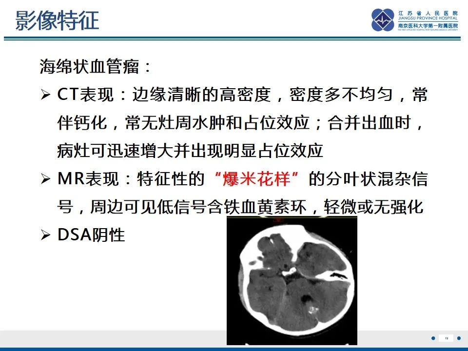 影像PPT - 【PPT】海绵状血管瘤伴发育性静脉畸形-20