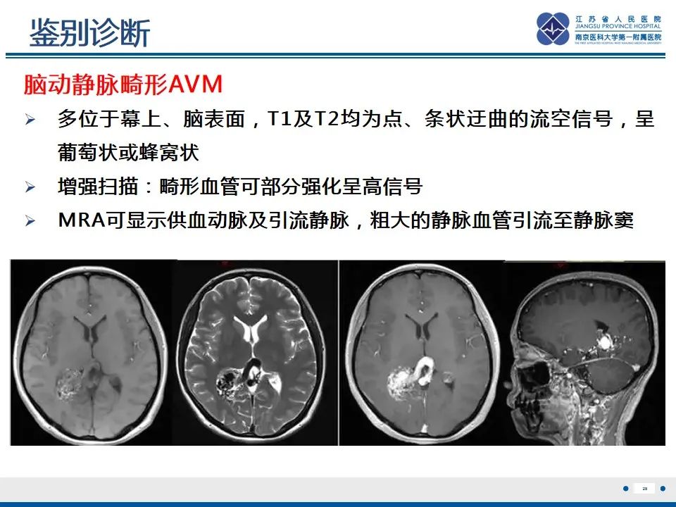 影像PPT - 【PPT】海绵状血管瘤伴发育性静脉畸形-29