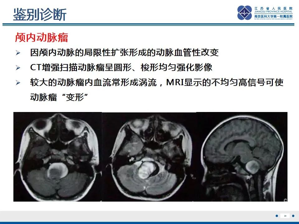 影像PPT - 【PPT】海绵状血管瘤伴发育性静脉畸形-30