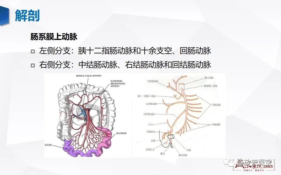 影像PPT - 【PPT】急性肠系膜血管栓塞的影像诊断-8