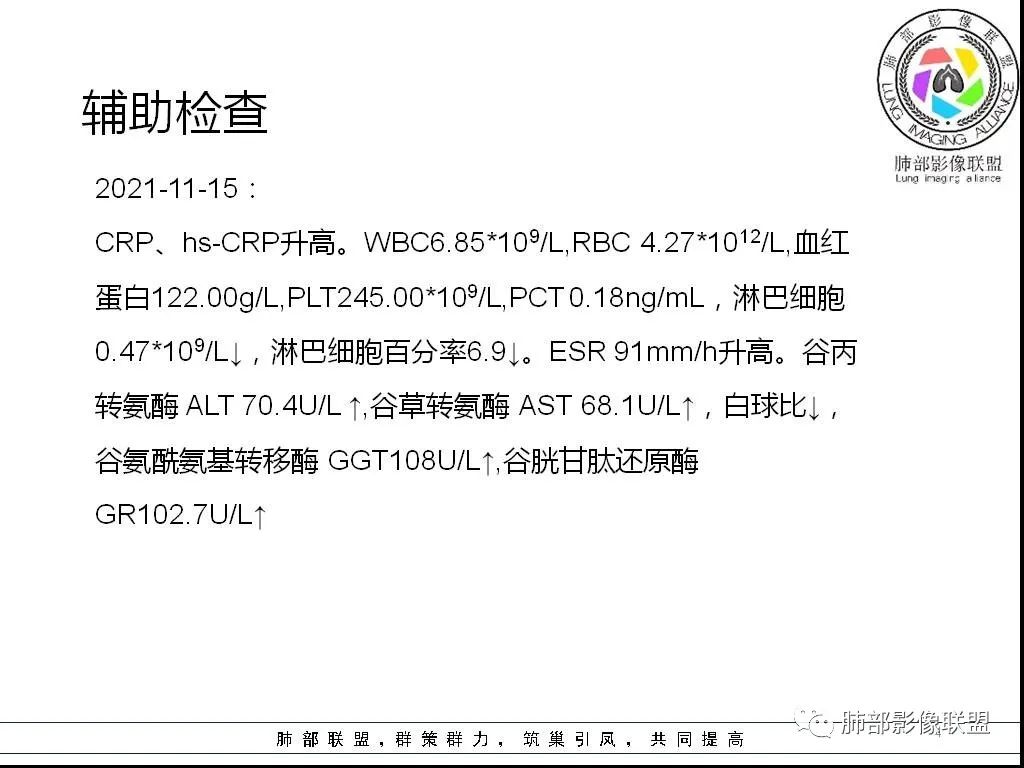影像PPT - 【病例】HIV背景下的双肺多发性小结节-4 影像PPT - 【病例】HIV背景下的双肺多发性小结节-4