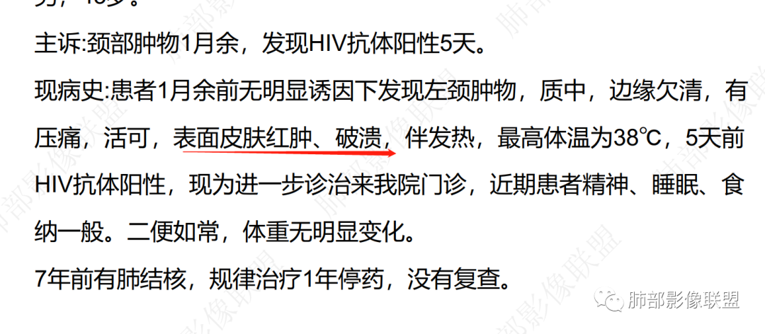 影像PPT - 【病例】HIV背景下的双肺多发性小结节-26 影像PPT - 【病例】HIV背景下的双肺多发性小结节-26