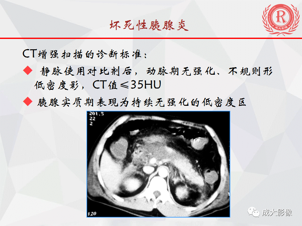 影像PPT - 【PPT】急慢性胰腺炎影像评价-9