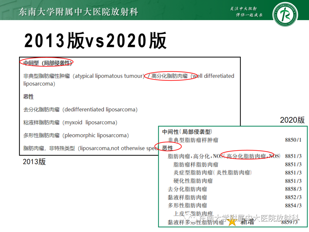 影像PPT - 【PPT】腹膜后脂肪肉瘤-9