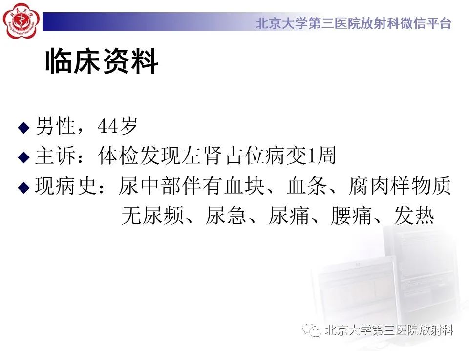 影像PPT - 【PPT】肾脏平滑肌瘤-2