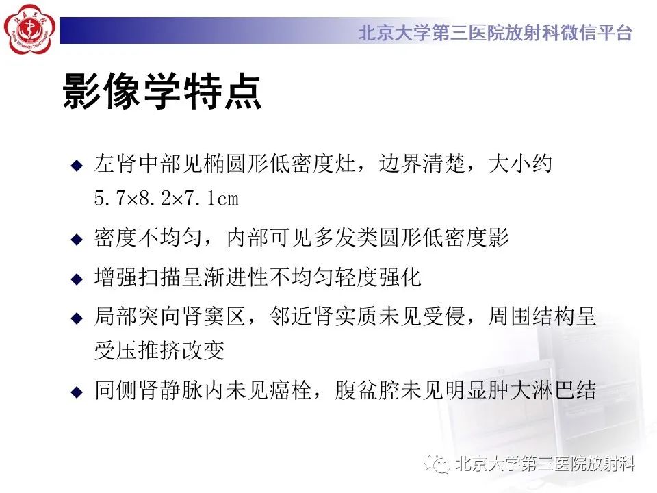 影像PPT - 【PPT】肾脏平滑肌瘤-6