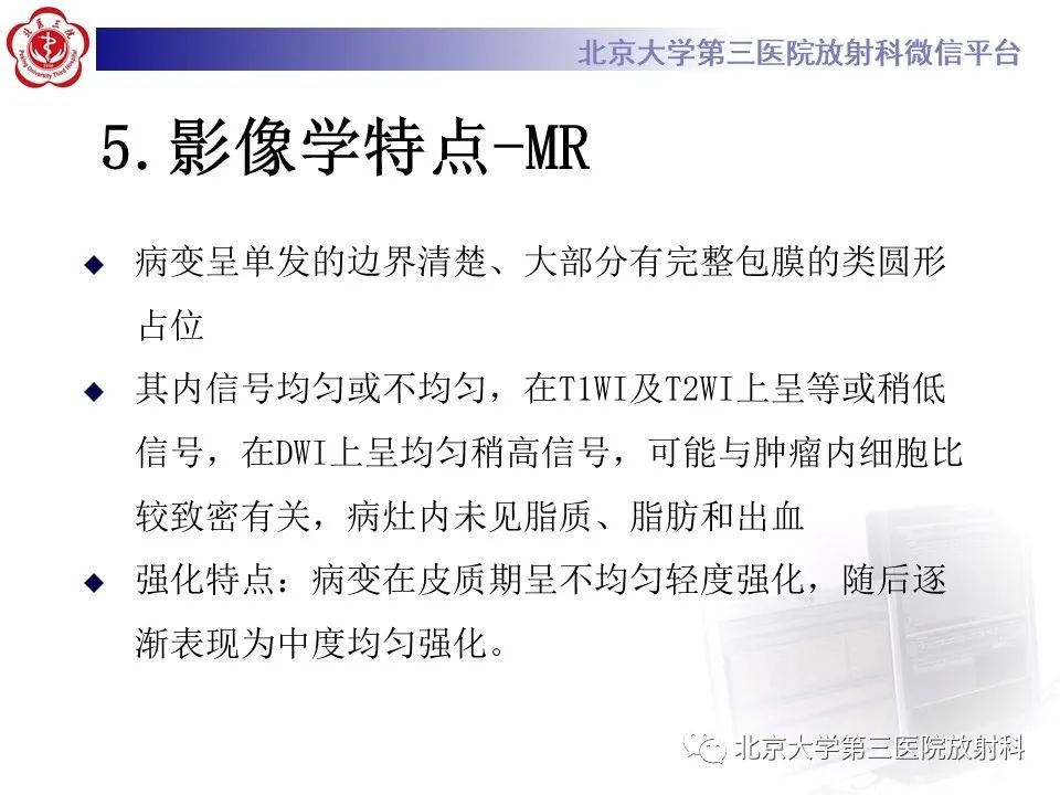 影像PPT - 【PPT】肾脏平滑肌瘤-17