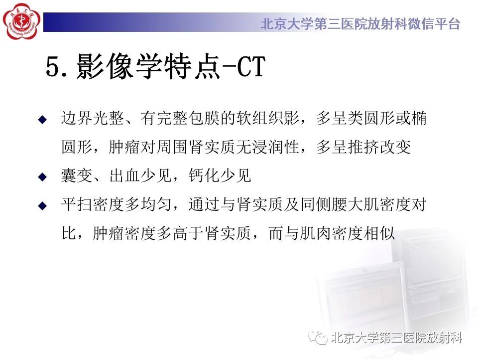 影像PPT - 【PPT】肾脏平滑肌瘤-15