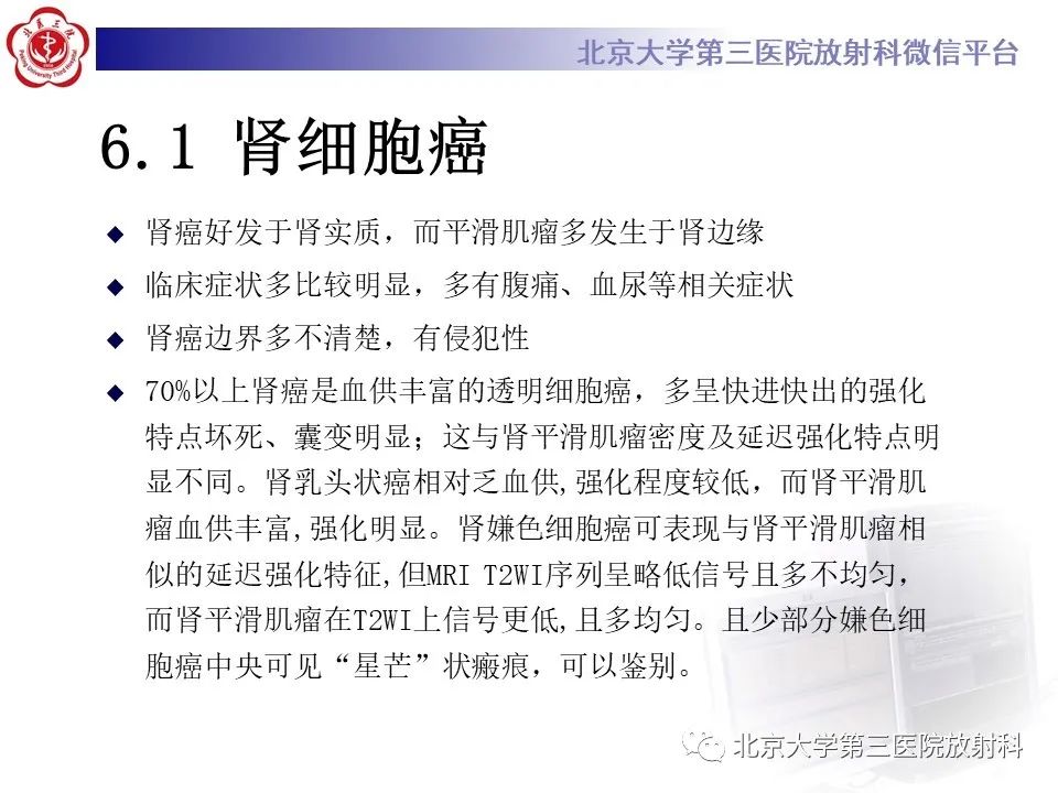 影像PPT - 【PPT】肾脏平滑肌瘤-19