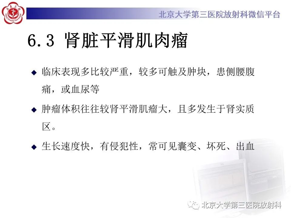 影像PPT - 【PPT】肾脏平滑肌瘤-25